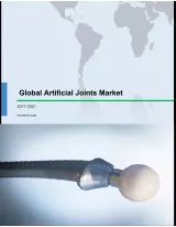 Global Artificial Joints Market 2017-2021